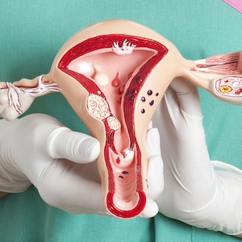 prevenzione del tumore al collo dell’utero